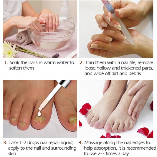 Nail Serum for Foot Care and Fungus Removal Gel